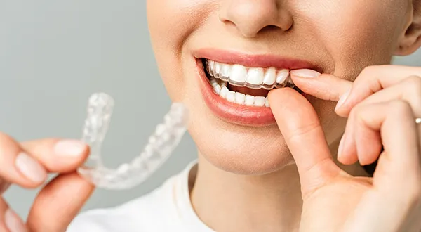 Types of Orthodontic Treatments for Adults