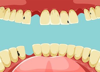 orthodontic emergency