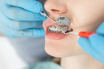 qualified orthodontist