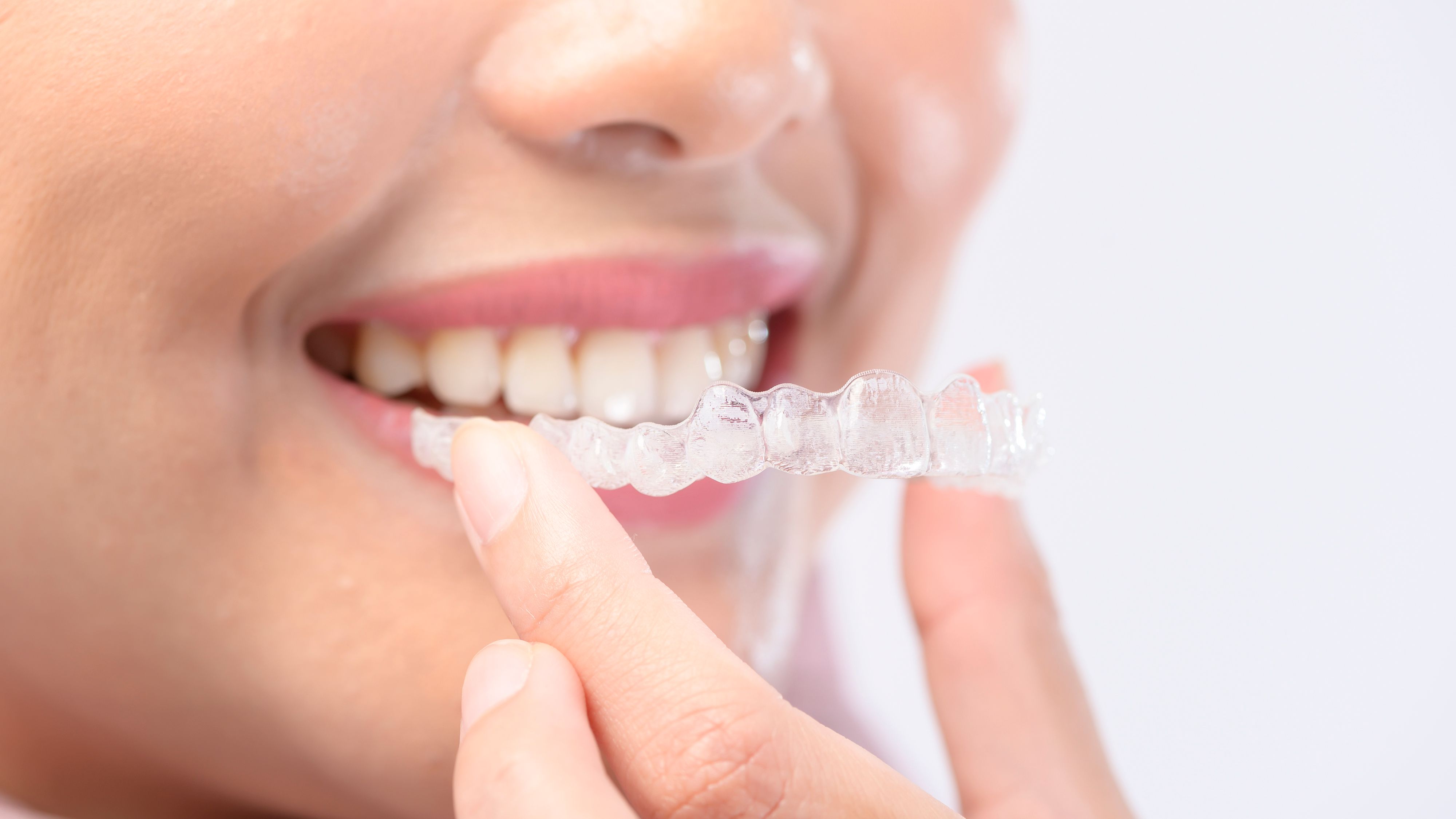 How to care for your Invisalign aligners?