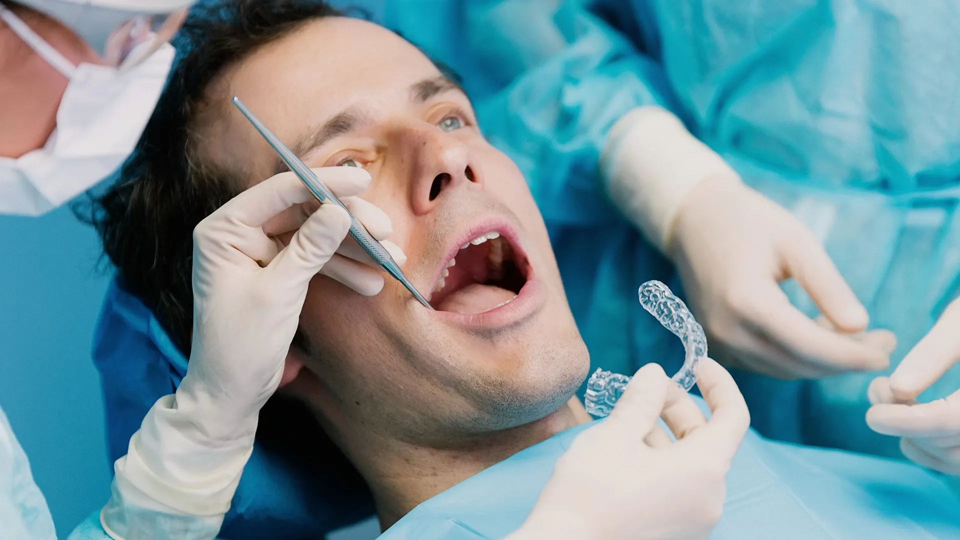 TEETH-best-wisdom-tooth-extraction-Singapore-1.webp