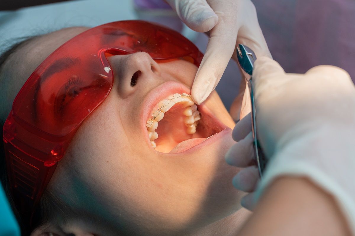 When to Call Your Orthodontist: Signs of Orthodontic Emergencies.