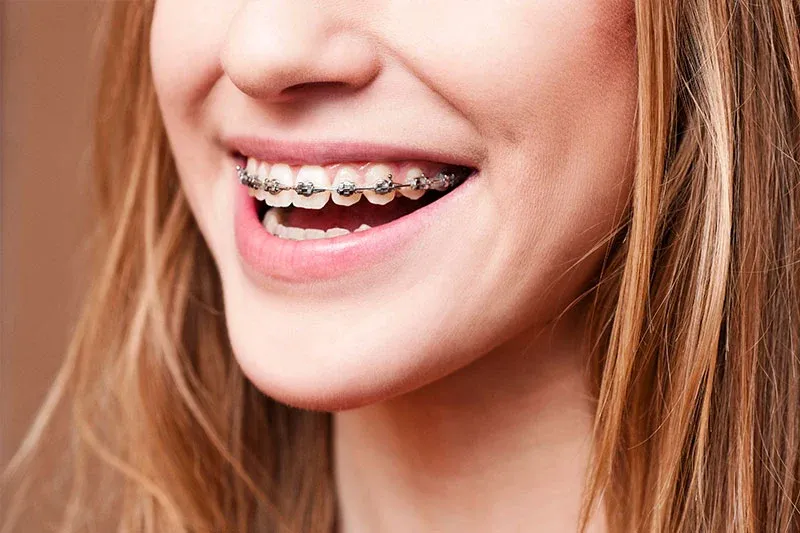 orthodontics.webp