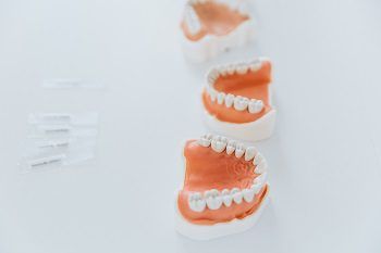 Orthodontic surgery